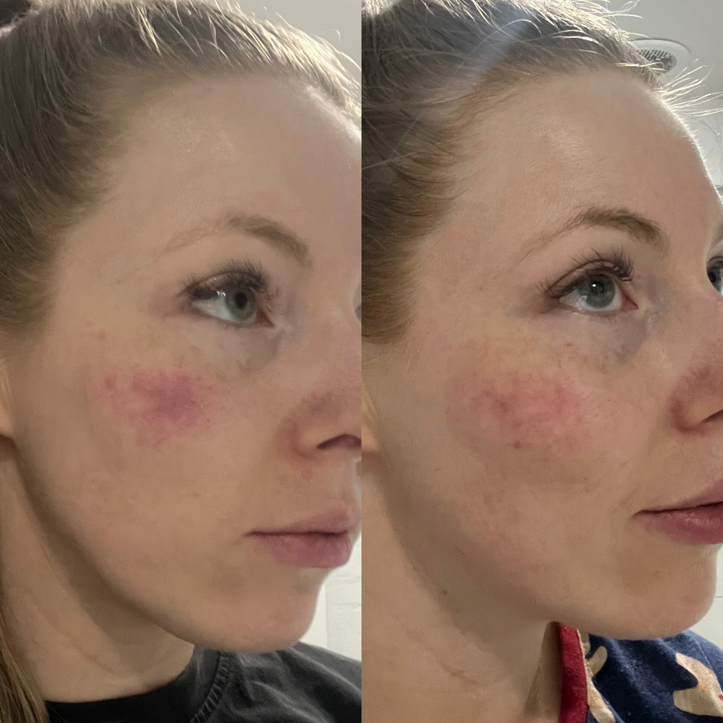 Unflavoured Collagen Bundle